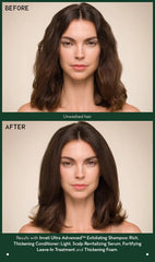 invati ultra advanced™ rich system